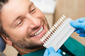 Fațetele dentare: Soluția estetică pentru dinții neuniformi sau decolorați