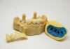În ce situații implantul dentar este cea mai bună soluție de restaurare?