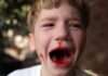 Trauma dentară la copil? Cum să răspunzi rapid și eficient în caz de accident