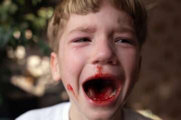 Trauma dentară la copil? Cum să răspunzi rapid și eficient în caz de accident